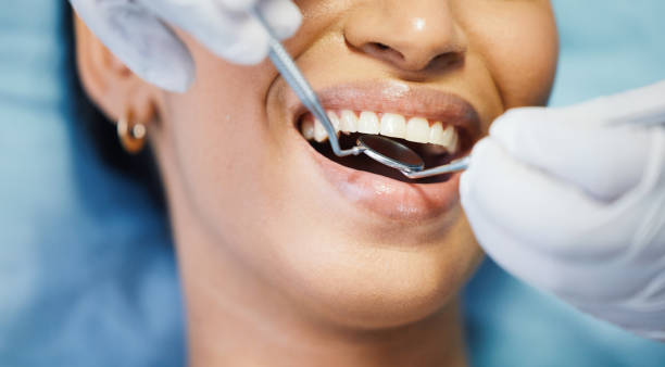 Professional  Dental Services in Santa Clara, CA